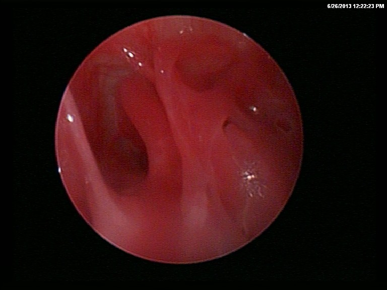 surgery-8